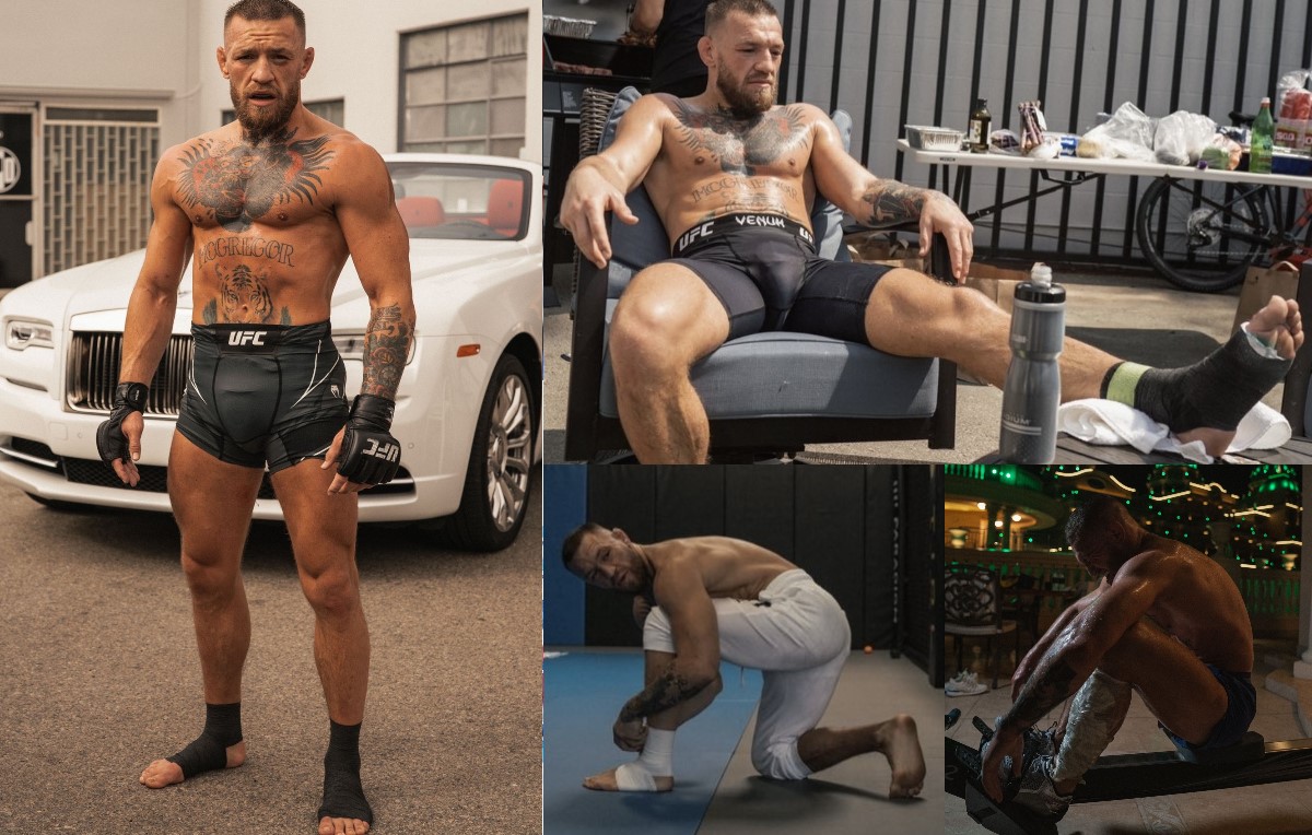 Conor McGregor has published evidence of an injury before the fight with Dustin Poirier at UFC 264