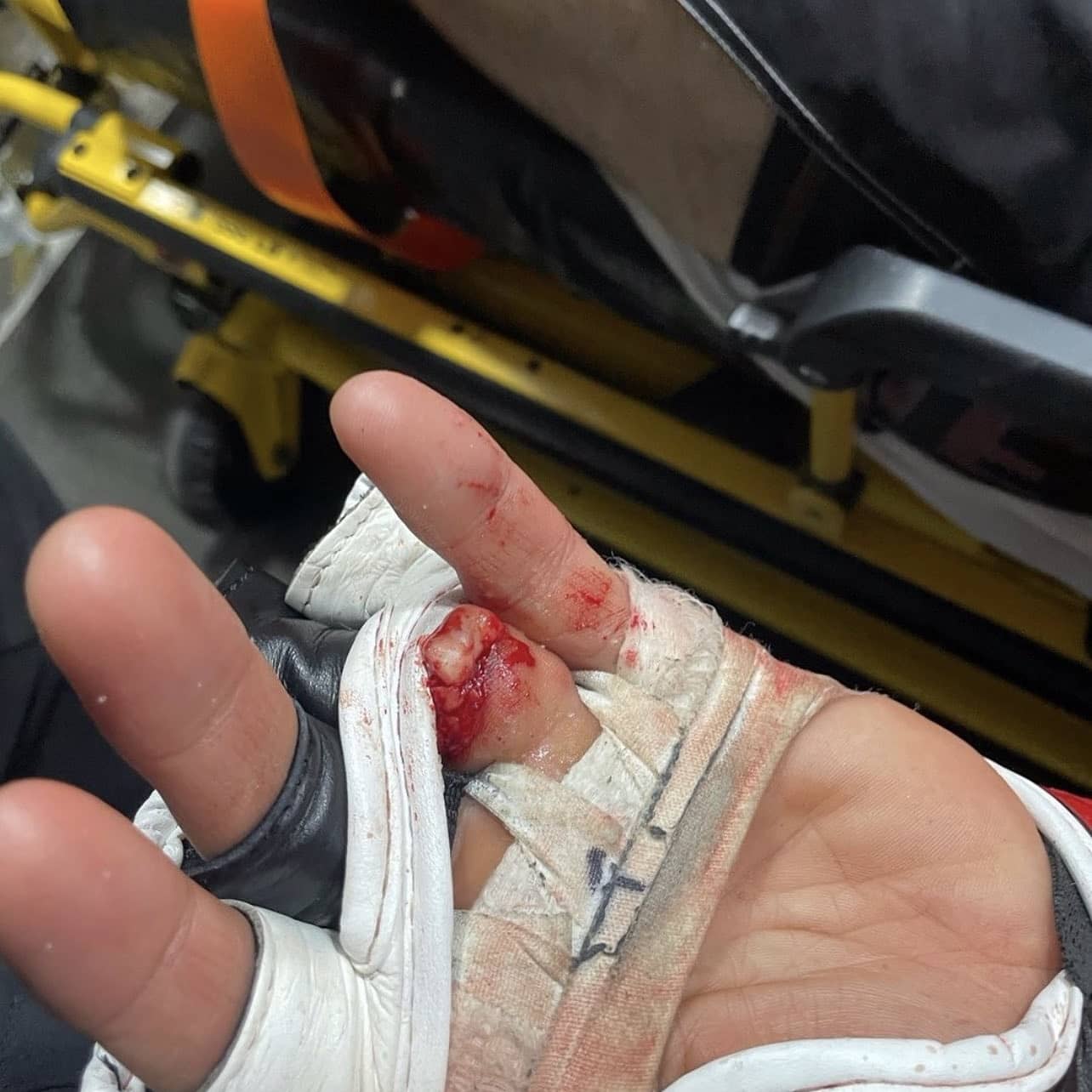 MMA fighter Khetag Pliev from Ossetia fought a whole round with a severed finger.